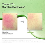 Anua Azelaic Acid 10 Hyaluron Redness Soothing Serum, Facial Serum for Sensitive skin, Hyaluronic Acid, Niacinamide