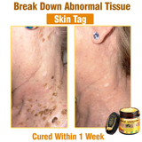𝐋𝐎𝐕𝐈𝐋𝐃𝐒™ 𝐁𝐞𝐞 𝐕𝐞𝐧𝐨𝐦 𝐀𝐥𝐥-𝐢𝐧-𝐎𝐧𝐞 𝐂𝐫𝐞𝐚𝐦–🌸 Anti-aging,Hydrating, Skin Repair, Even Tone, Acne and Dark Spot Treatment, Wart and Mole Removal, Psoriasis Relief