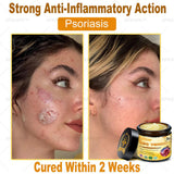 Professional Bee Venom Repair Cream, For All Body Parts