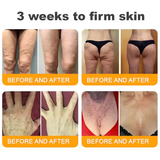 𝐋𝐎𝐕𝐈𝐋𝐃𝐒™ 𝐁𝐞𝐞 𝐕𝐞𝐧𝐨𝐦 𝐀𝐥𝐥-𝐢𝐧-𝐎𝐧𝐞 𝐂𝐫𝐞𝐚𝐦–🌸 Anti-aging,Hydrating, Skin Repair, Even Tone, Acne and Dark Spot Treatment, Wart and Mole Removal, Psoriasis Relief