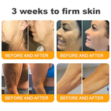 𝐋𝐎𝐕𝐈𝐋𝐃𝐒™ 𝐁𝐞𝐞 𝐕𝐞𝐧𝐨𝐦 𝐀𝐥𝐥-𝐢𝐧-𝐎𝐧𝐞 𝐂𝐫𝐞𝐚𝐦–🌸 Anti-aging,Hydrating, Skin Repair, Even Tone, Acne and Dark Spot Treatment, Wart and Mole Removal, Psoriasis Relief