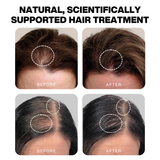 Hair Treatment Serum Essential Oil | Hair Growth Scalp | Hair Scalp Massager