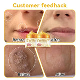 HOUKEA™Bee Venom Cream (Original)